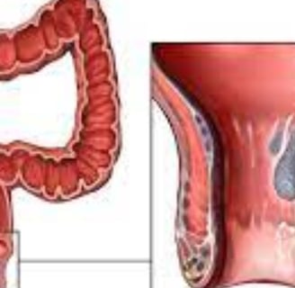 the small intestine beyond the duodenum, the colon, rectum, and anal canal.