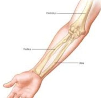 arm fractures