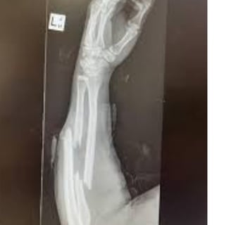 Why do some break when they fall down Without Getting Injured (1)