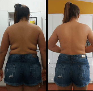 mulher mostrando fotos de antes e depois do seu emagrecimento