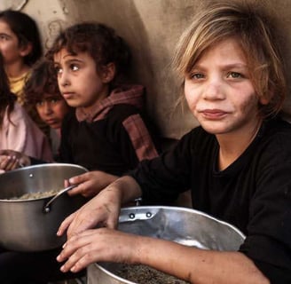 alnourished child in Gaza amidst worsening famine crisis. Starvation continues to impact Gaza’s youn