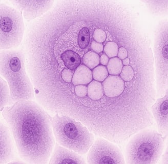 Histologia câncer de colo