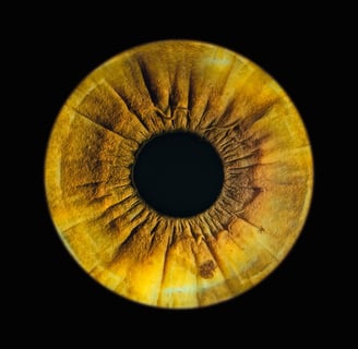 a eye gallery