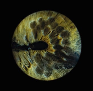 zdjęcie tęczówki oka wykonane w A-EYE Gallery. oko z rozszczepem tęczówki, wyglądające jak ogon pawia