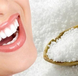 tẩy trắng răng tại nhà
