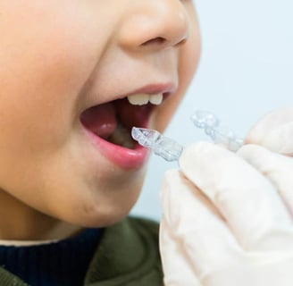 trẻ em niềng răng trong suốt