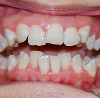 răng lệnh lạc