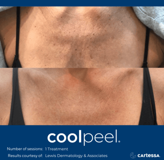 a woman with a very large chest and a very small chest