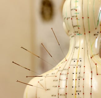 Acupuncture