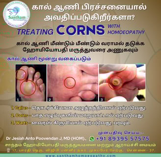 Foot Corn Homoeopathic medicine