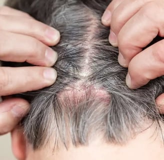 Top Sulfate-Free Shampoos for Itchy Scalps