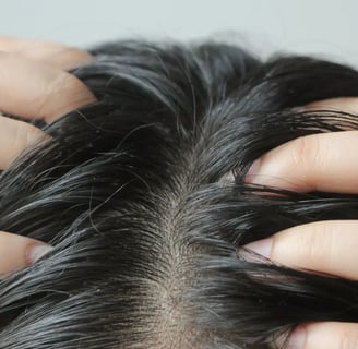 Top Sulfate-Free Shampoos for Itchy Scalps