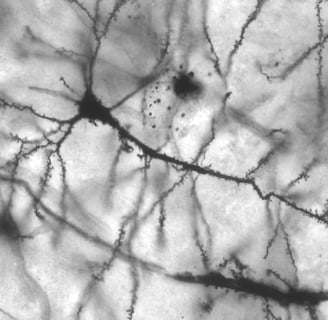Neurons featuring dendritic spines