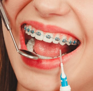 Close-up of traditional metal braces on teeth, demonstrating effective orthodontic treatment