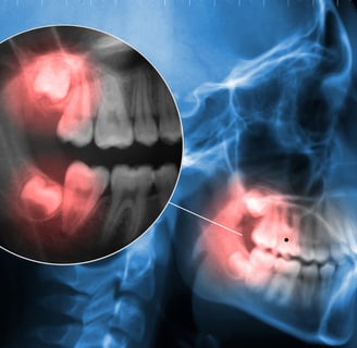Close-up of a patient receiving dental examination for a painful toothache