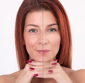 Before and after skincare treatment on redhead woman.