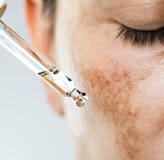 Woman applying serum to reduce hyperpigmentation and improve skin texture.