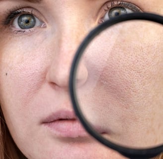 Close-up of large skin pores magnified.