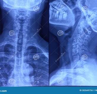 a x - ray of a skeleton in a medical device
