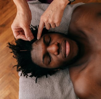 a man with black hair and darker skin is relaxing while receiving acupuncture 