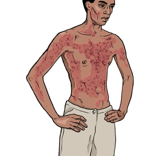 ebola virus causes and treatment