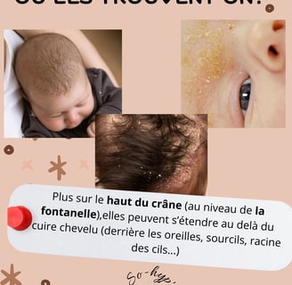 soin nouveau né loire