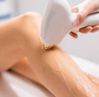 laser hair removal on legs
