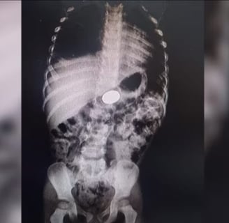 a dog's chest and chest x - ray image of a dog's