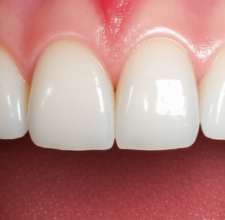implants dentaire Tunisie