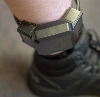 GPS ankle monitor on a client's leg for monitoring.