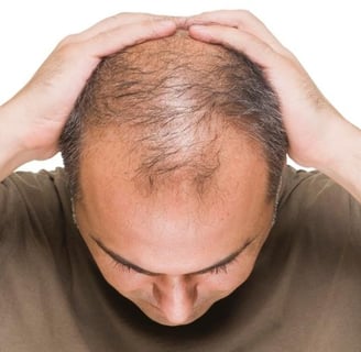 Quais os Melhores Suplementos para Queda de Cabelo