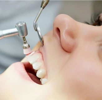 a child's teeth whitening is a great way to get ridded up