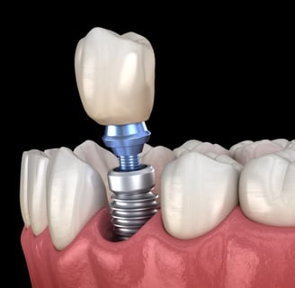 vis de cicatrisation implant dentaire