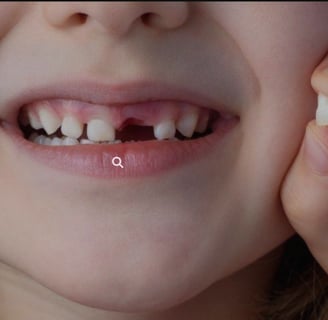 dientes de leche