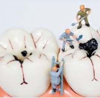 caries