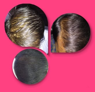 Skindent's Rejuvenate Trichology Services Hair
