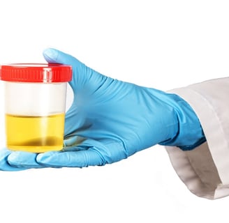 Urinary Tract Infection, Burning, Pee, Urine, Frequency, Antibiotics, Tests, Testing, UTI