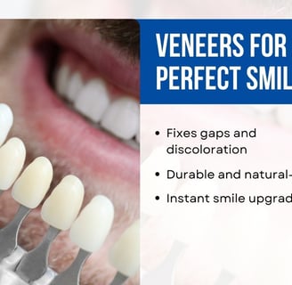 Boring Digital Marketing Idea for Veneers