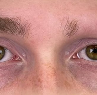 Powder Brows bei Alopezie: Wiederherstellung Ihrer Augenbrauen
