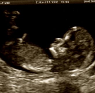 ultrasound image copyrighted