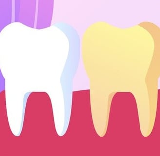 causes demineralisation of teeth hygiene-precision.com