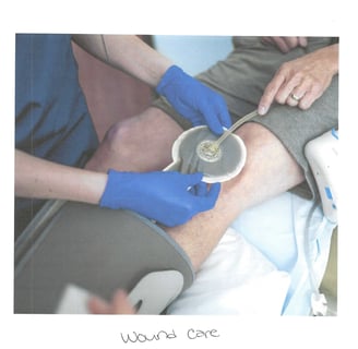 a nurse applying wound vac on patient wound.