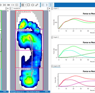 foot pressure mapping