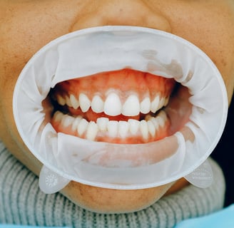 how to get rid of cavity smell
