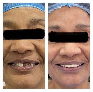 smile designing holy smile kolkata