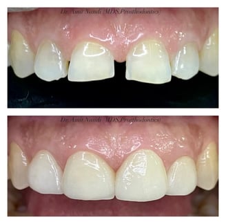 best smile designed dental kolkata
