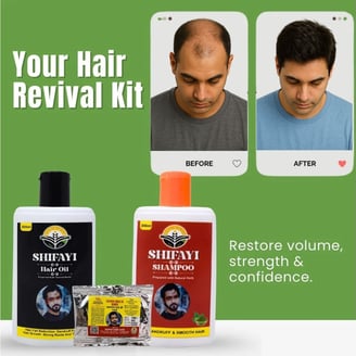 Shifayi Herbal hair products Alopecia Results