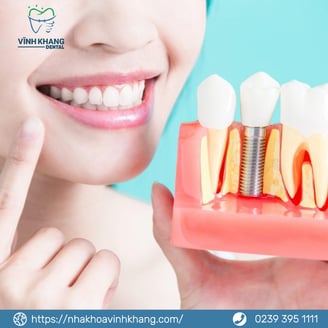 trồng răng Implant