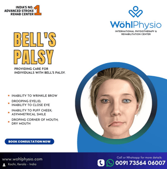 Treatment for Bells Palsy in Kerala