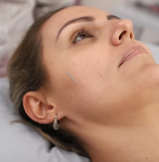 Dry Needling 